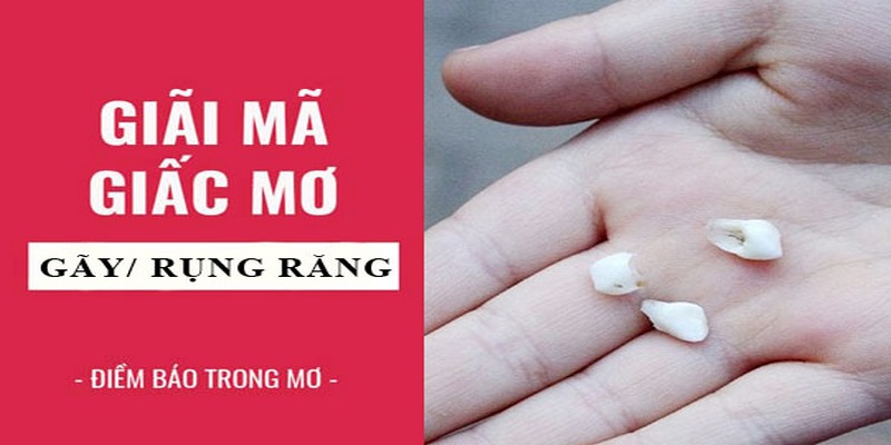 Giải Mã Mơ Thấy Răng Rụng Mang Đến Ý Nghĩa Đặc Biệt Nào?